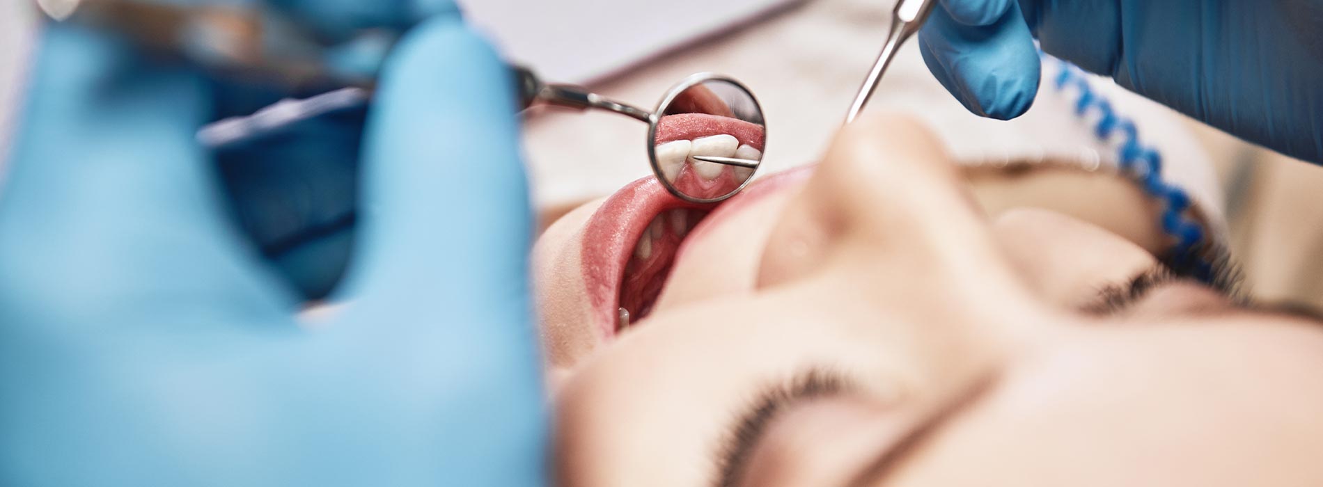 A person s face is being worked on by a dental professional, with visible dental tools and blue gloves.